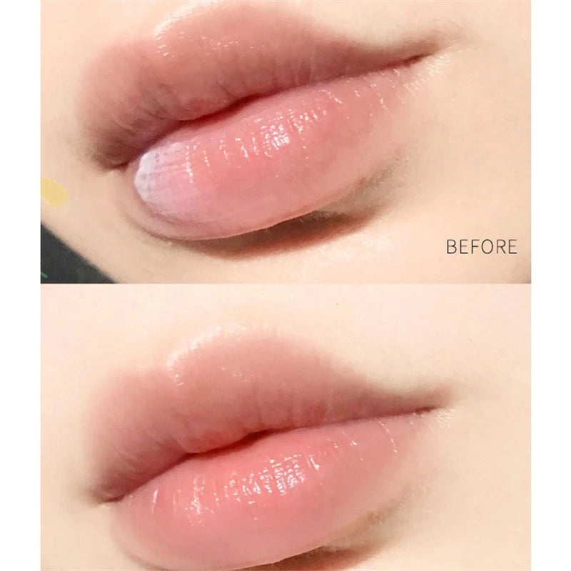 Lip Balm