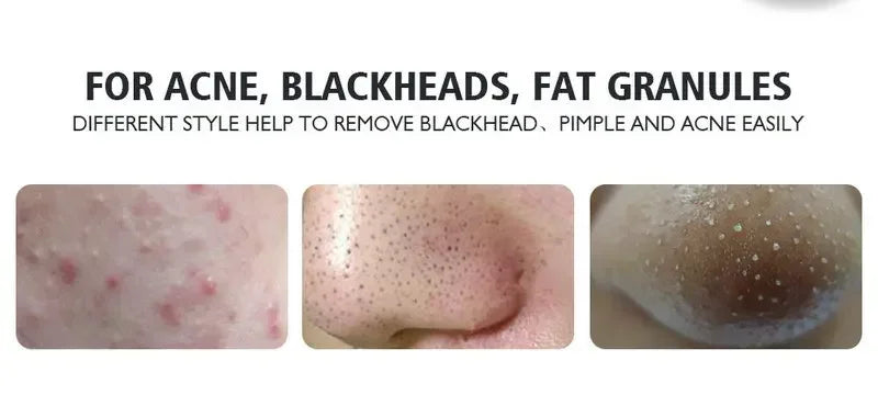 Spot Blemish Remover Skin Care