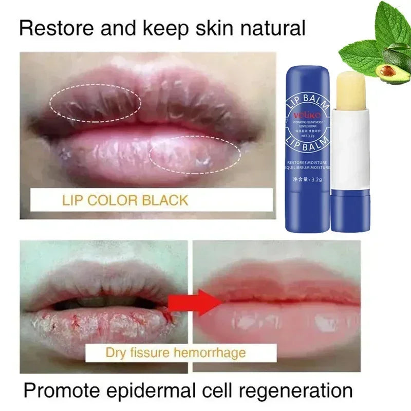 Remove Dark Lip Balm