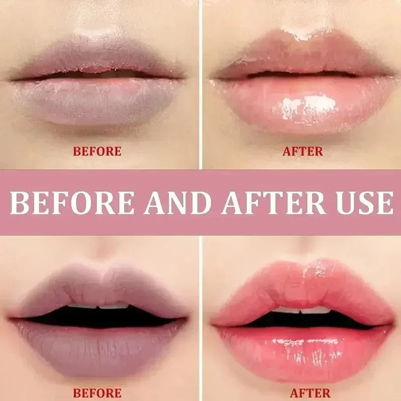 Remove Dark Lip Balm